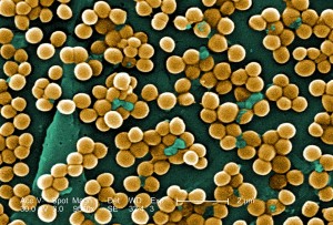 จุลินทรีย์ Staphylococcus aureus